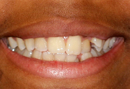 cedar grove dental before