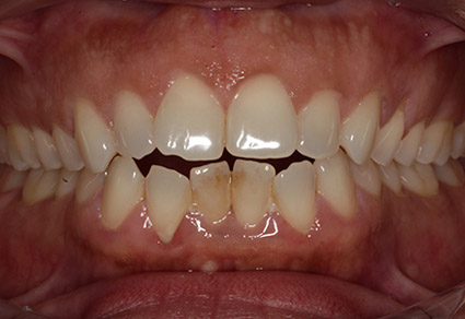 cedar grove dental after results