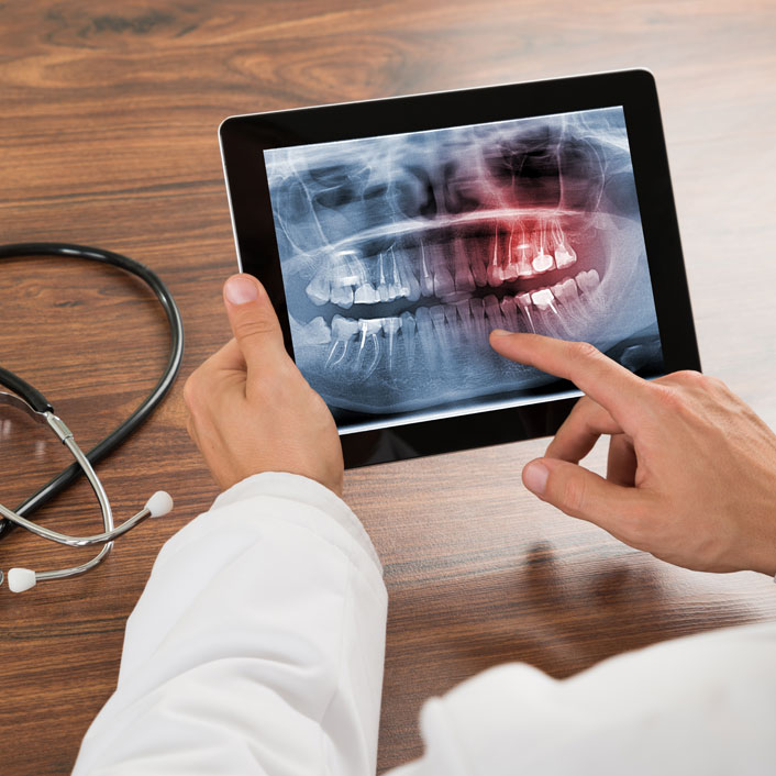 cedar grove dental xray