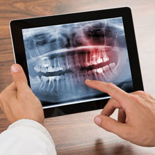 digital xrays of your mouth
