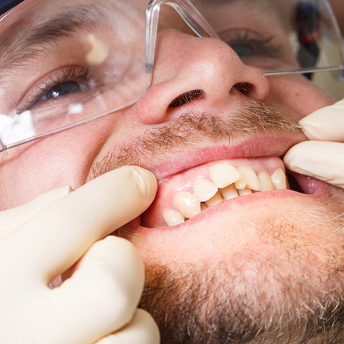 gum treatment