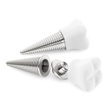 dental implant solutions